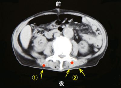 ���Ő���