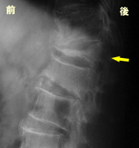 ���ň�������