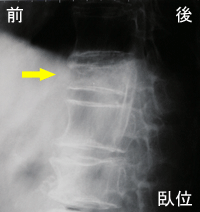 ���ň�������