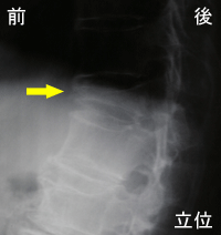 ���ň�������