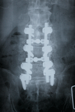 �㑤���Œ�p