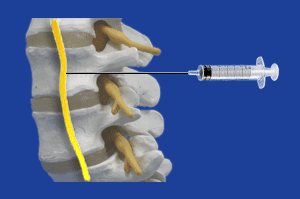 ���������_�o�߃u���b�N